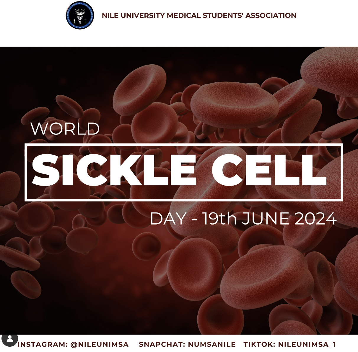 NUMSA World Sickle Cell Day 2024